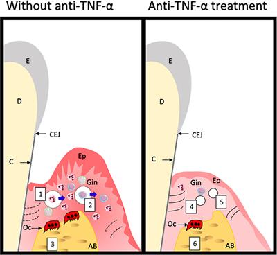Use of TNF Inhibitors in Rheumatoid Arthritis and Implications for the Periodontal Status: For the Benefit of Both?